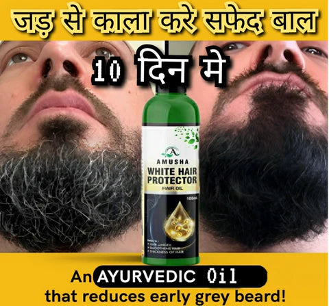 White Hair Protector Hair Oil - ❤️For Both Men & Women❤️🔥BUY 1 GET 1 FREE 🔥