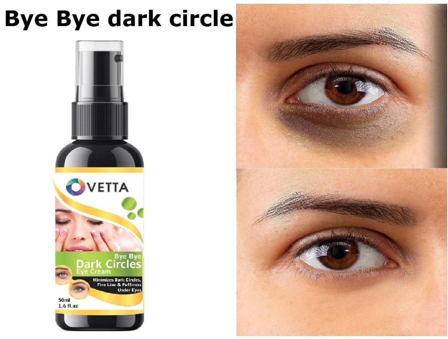 Ovetta Dark Circles Eye Cream(Pack of 1)